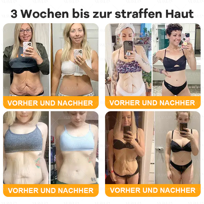 Hergestellt und versendet aus Deutschland ✨ VLSVLS® Bienengift Hautregenerationscreme 🔥 LETZTER TAG 80 % RABATT 💛💛💛