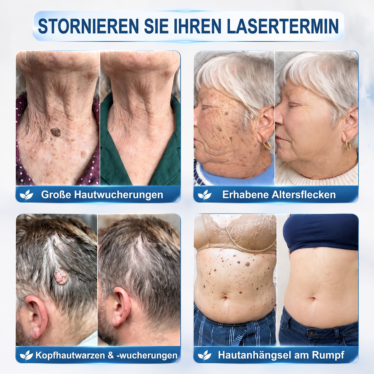 𝐇𝐈𝐒𝐊𝐈𝐍®👩‍⚕️⭐ 7-Tage-Hautmakel- & Hautanhängsel-Entferner Schmerzfreier Rollerball-Stift zur schonenden Entfernung von Hautanhängseln und Hautflecken – narbenfrei💚