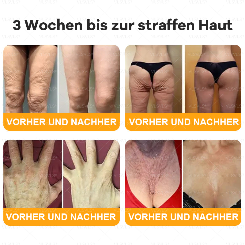 Hergestellt und versendet aus Deutschland ✨ VLSVLS® Bienengift Hautregenerationscreme 🔥 LETZTER TAG 80 % RABATT 💛💛💛