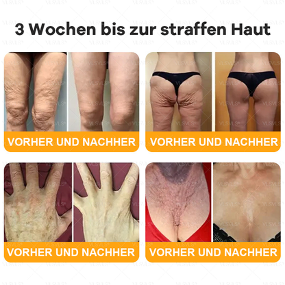 Hergestellt und versendet aus Deutschland ✨ VLSVLS® Bienengift Hautregenerationscreme 🔥 LETZTER TAG 80 % RABATT 💛💛💛