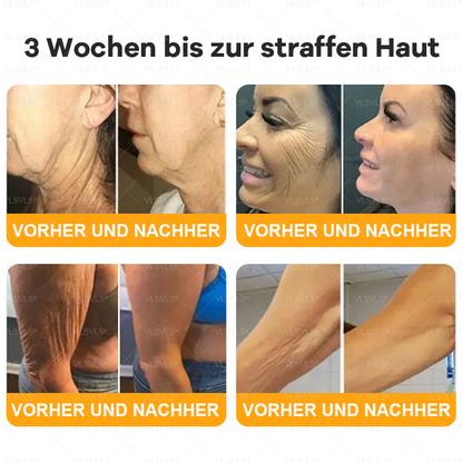 Hergestellt und versendet aus Deutschland ✨ VLSVLS® Bienengift Hautregenerationscreme 🔥 LETZTER TAG 80 % RABATT 💛💛💛