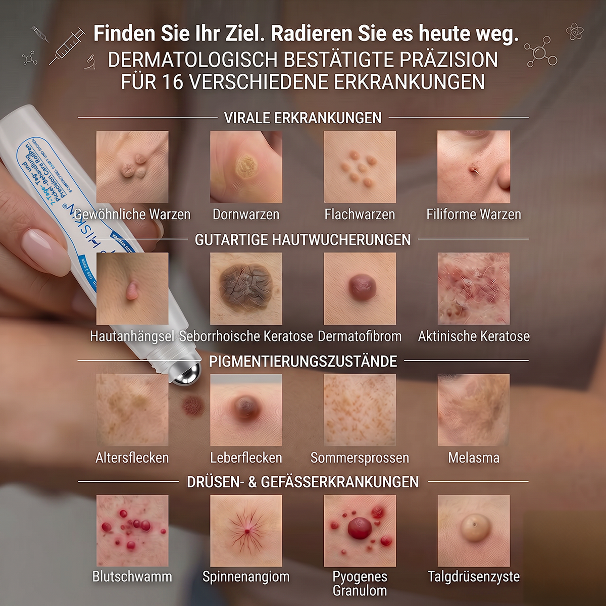 𝐇𝐈𝐒𝐊𝐈𝐍®👩‍⚕️⭐ 7-Tage-Hautmakel- & Hautanhängsel-Entferner Schmerzfreier Rollerball-Stift zur schonenden Entfernung von Hautanhängseln und Hautflecken – narbenfrei💚