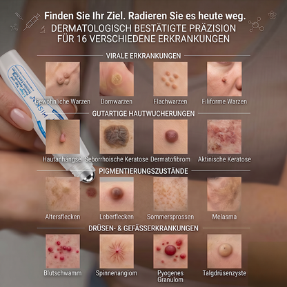 𝐇𝐈𝐒𝐊𝐈𝐍®👩‍⚕️⭐ 7-Tage-Hautmakel- & Hautanhängsel-Entferner Schmerzfreier Rollerball-Stift zur schonenden Entfernung von Hautanhängseln und Hautflecken – narbenfrei💚